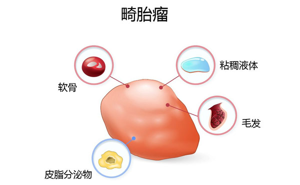 中兴e2633_同光中兴还是同治中兴_中兴中兴geek